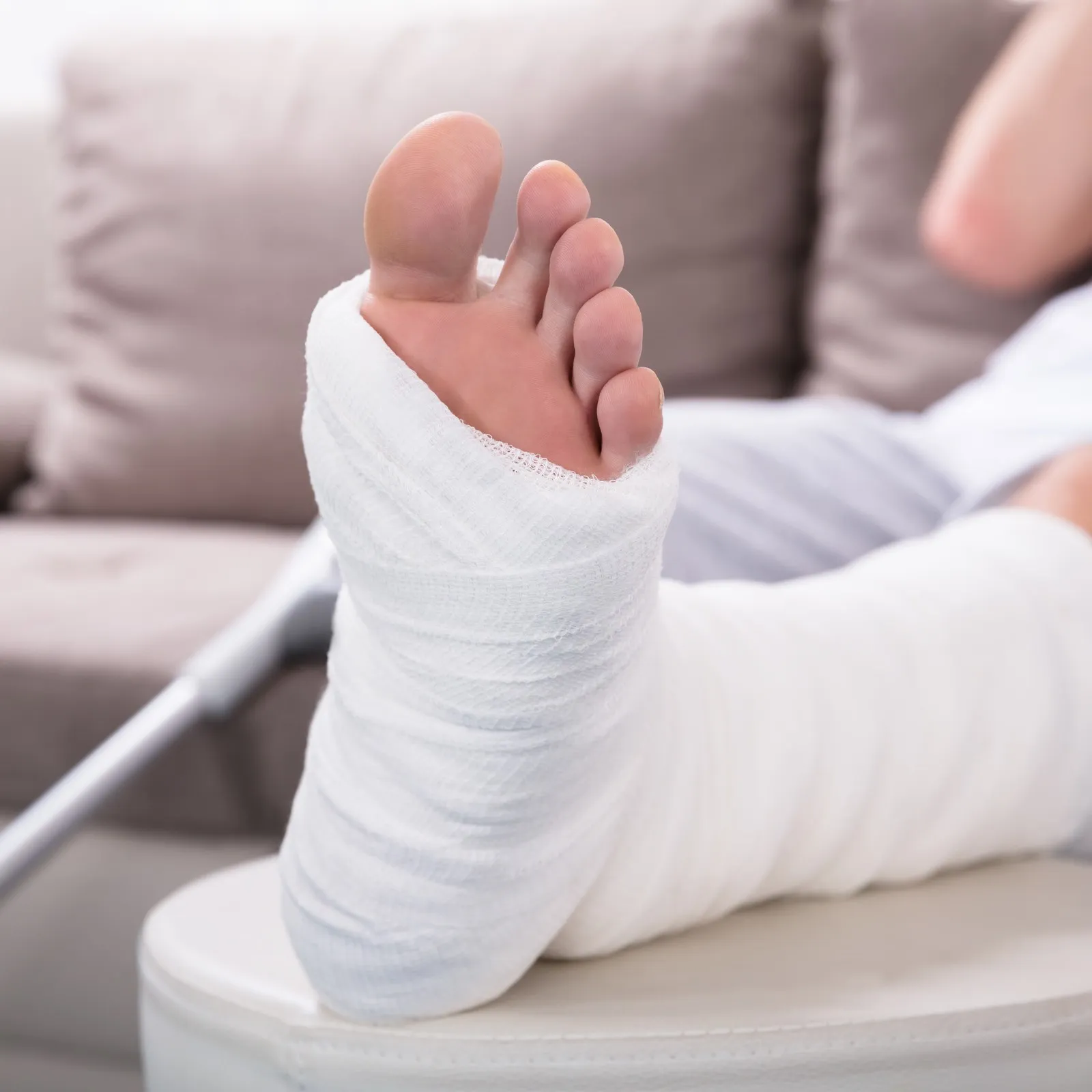 Ein Mann sitzt auf einem Sofa und hat sein gegipstes Bein hochgelegt.